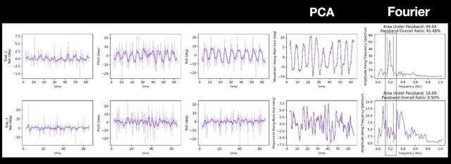 Smart Knee Brace Diagnostic Device thumbnail